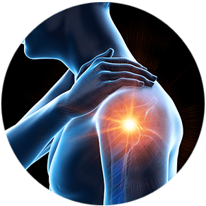 shoulder replacement