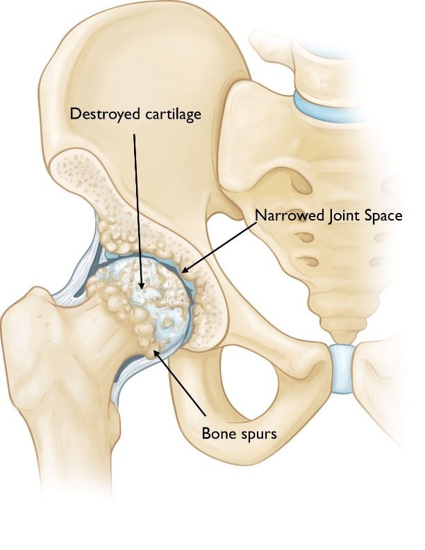 hip arthroscopy labral repair protocol